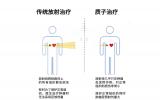 质子治疗技术，癌症也怕它？
